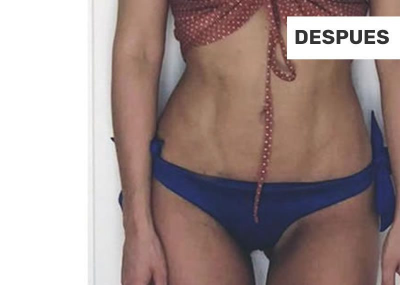 1-corporal-despues