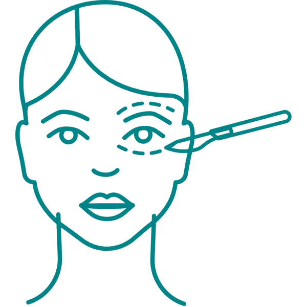 cirugia-rostro