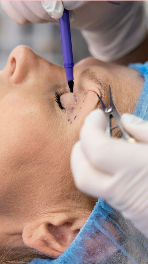 Tipos de blefaroplastia