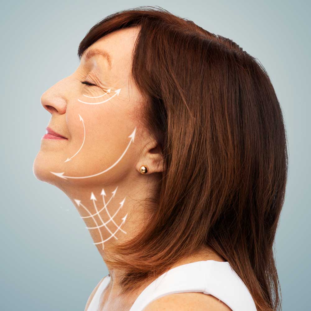 Lifting facial
