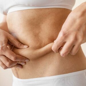 lipoabdominoplastia