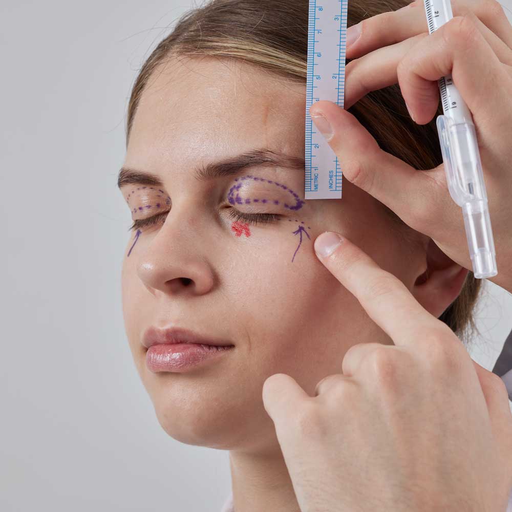 Tipo de blefaroplastia: superior, inferior o completa
