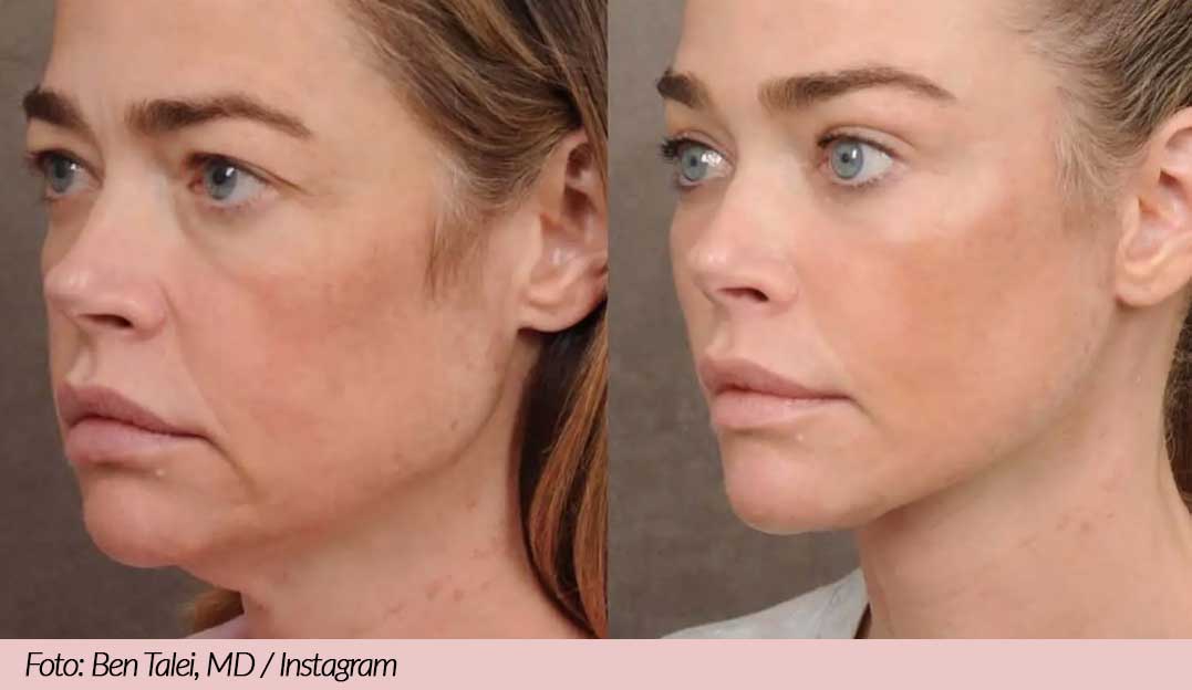 Lifting-de-Denise-Richards