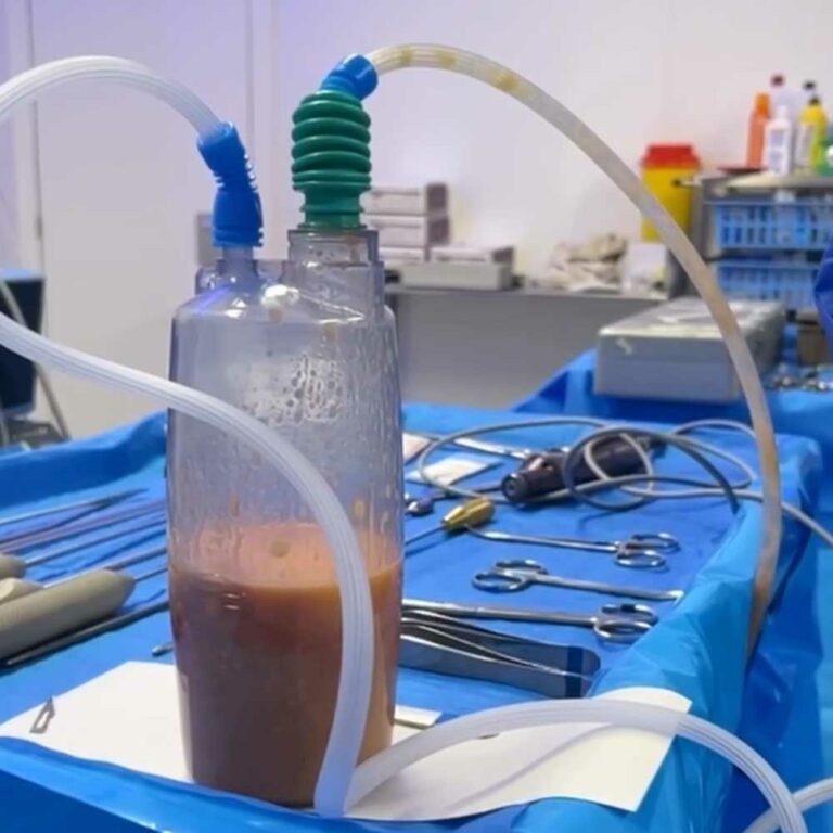 Tecnología utilizada durante la cirugía