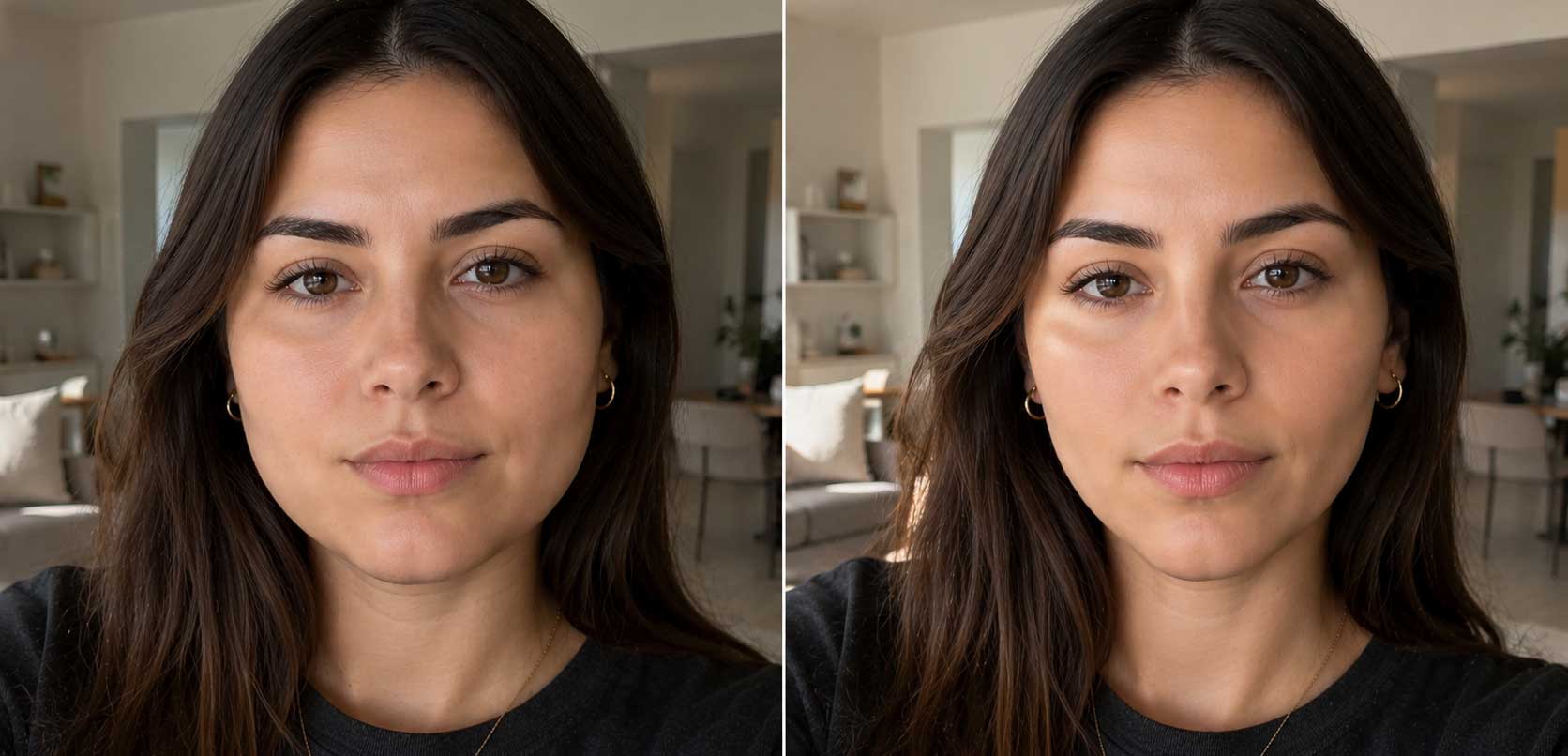 Qué es la bichectomía en mujeres